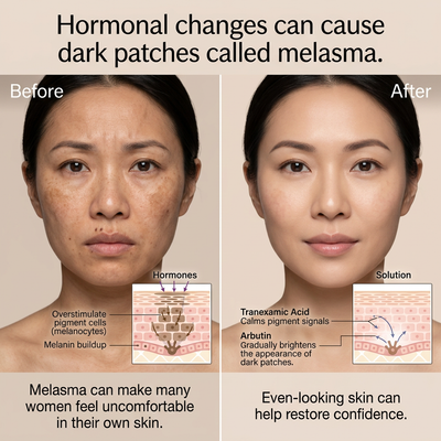 HSH ToneReset™ Dark Spot Corrector Cream