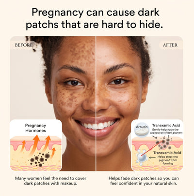 HSH ToneReset™ Dark Spot Corrector Cream