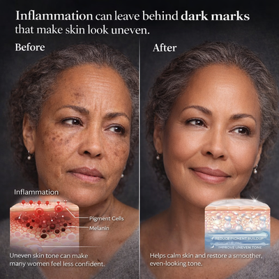 HSH ToneReset™ Dark Spot Corrector Cream